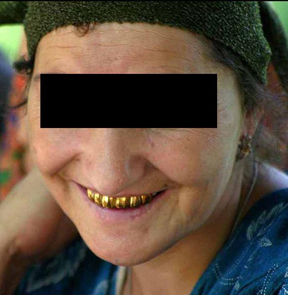 Tajikistan_gold_teeth_new.jpg